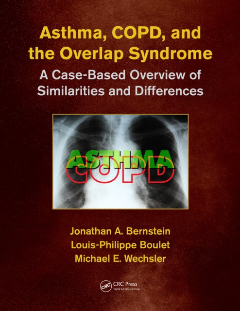 Book cover of: Asthma, COPD, and Overlap. By: Jonathan A. Bernstein