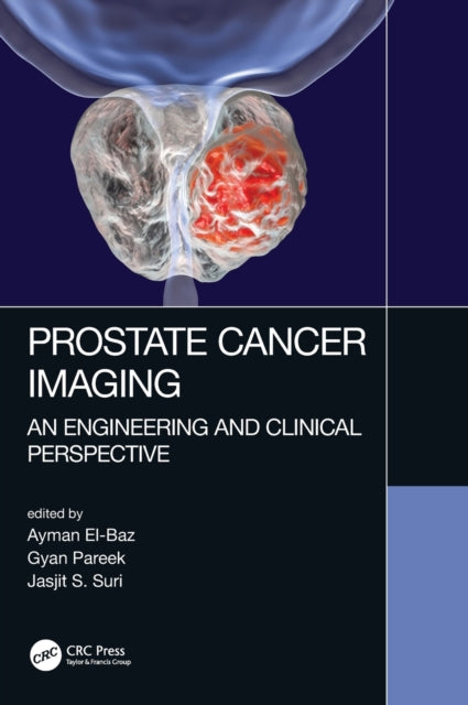 Prostate Cancer Imaging