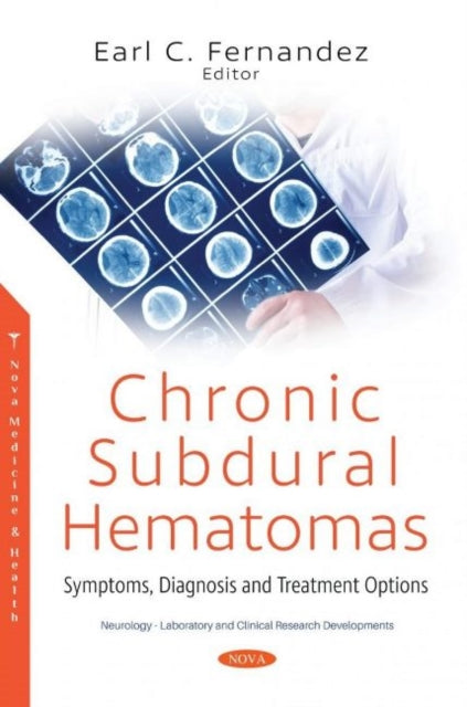 Book cover of: Chronic Subdural Hematomas. By: Earl C. Fernandez