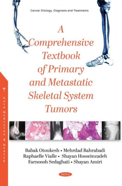 Book cover of: Comprehensive Textbook of Primary and Metastatic Tumors of the Skeletal System. By: Babak Otoukesh