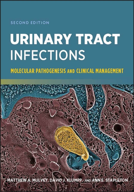 Book cover of: Urinary Tract Infections. By: Matthew A. Mulvey