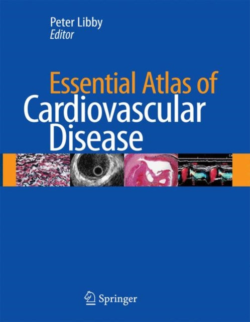 Book cover of: Essential Atlas of Cardiovascular Disease. By: Peter Libby