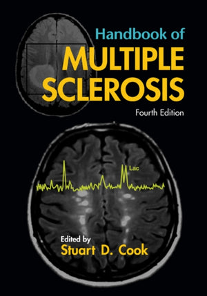 Handbook of Multiple Sclerosis