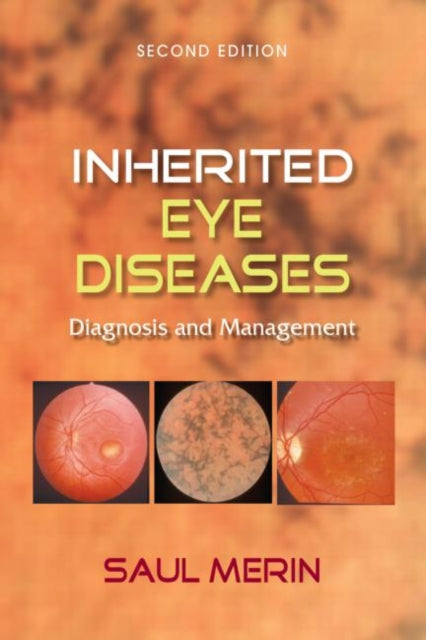 Book cover of: Inherited Eye Diseases. By: Saul Merin