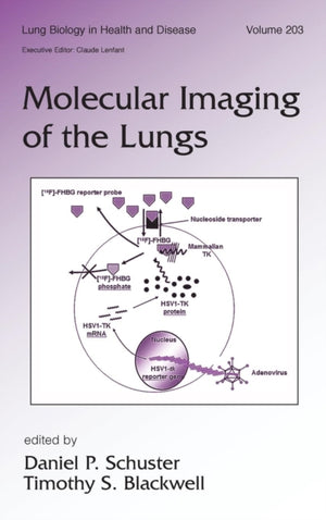 Molecular Imaging of the Lungs
