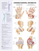 Book cover of: Understanding Arthritis Anatomical Chart