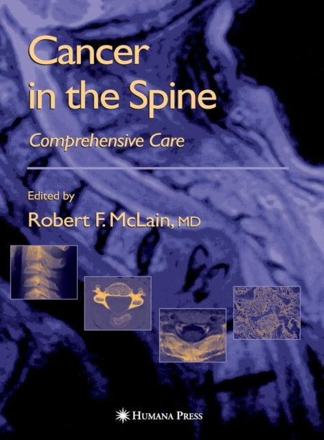 Book cover of: Cancer in the Spine