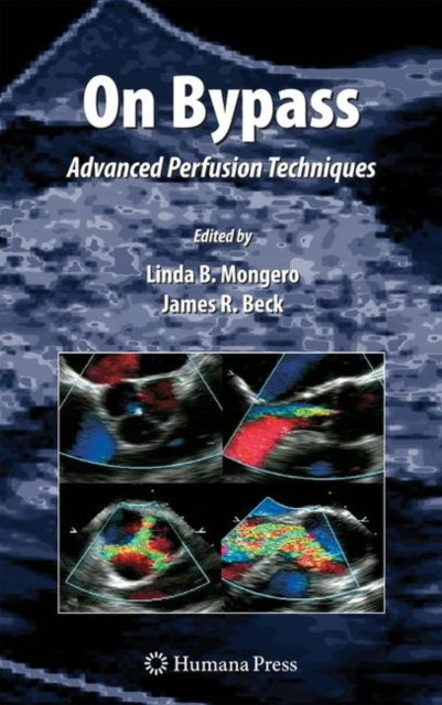 Book cover of: On Bypass