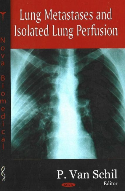 Book cover of: Lung Metastases & Isolated Lung Perfusion