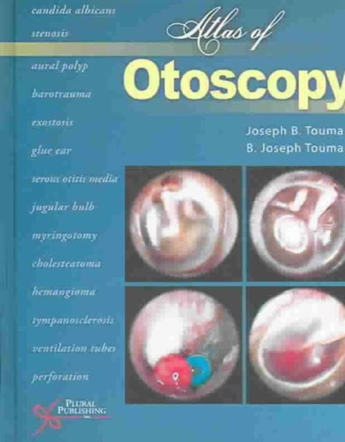 Book cover of: Atlas of Otoscopy. By: Joseph B., Ph.D. Touma