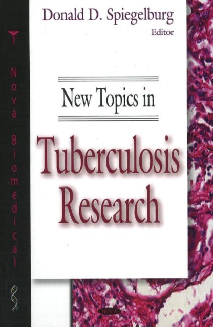 Book cover of: New Topics in Tuberculosis Research. By: Donald D. Spiegelburg