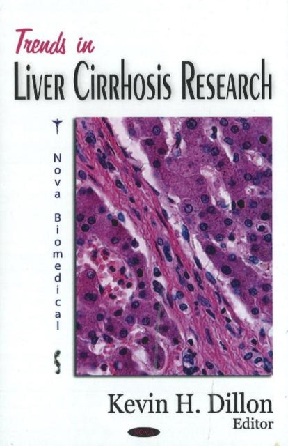 Book cover of: Trends in Liver Cirrhosis Research. By: Kevin H. Dillon