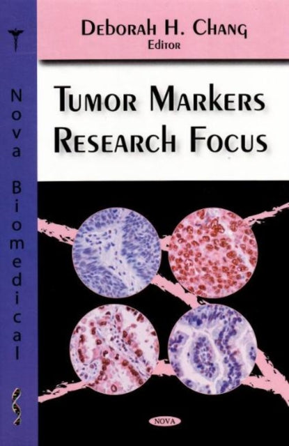 Book cover of: Tumor Markers Research Focus