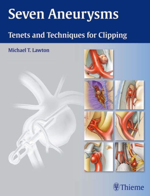 Book cover of: Seven Aneurysms. By: Michael T. Lawton