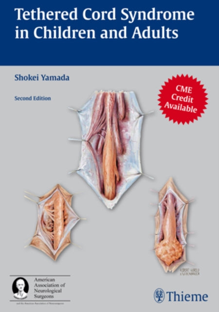 Book cover of: Tethered Cord Syndrome in Children and Adults