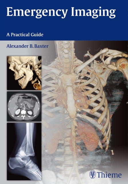 Book cover of: Emergency Imaging. By: Alexander B. Baxter