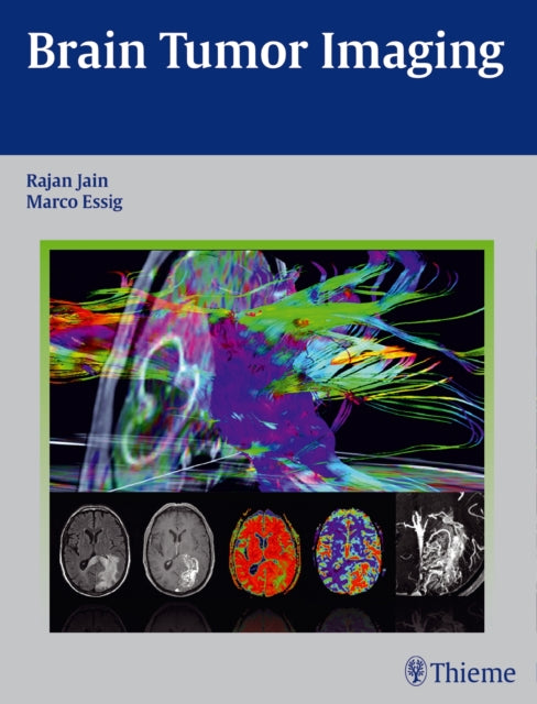 Book cover of: Brain Tumor Imaging. By: Rajan Jain