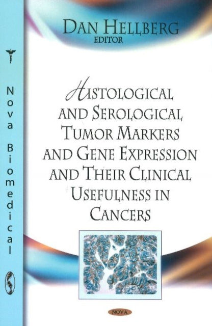 Book cover of: Histological & Serological Tumour Markers & Gene Expression & Their Clinical Usefulness in Cancers. By: Dan Hellberg