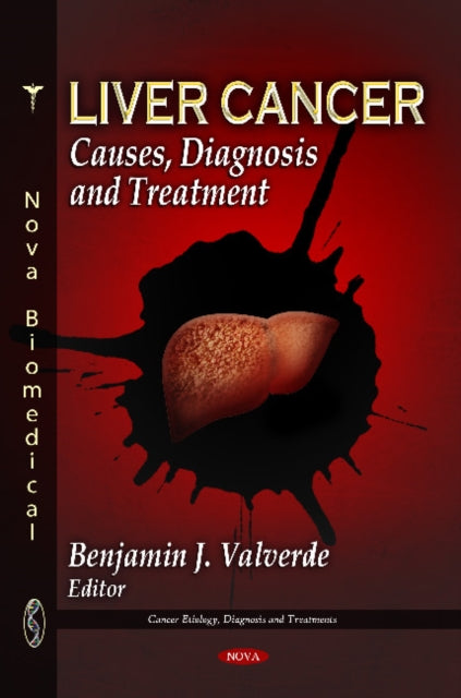 Book cover of: Liver Cancer. By: Benjamin J. Valverde