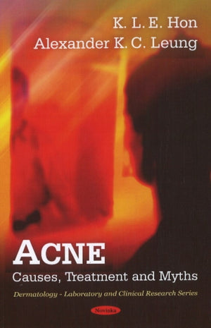Acne