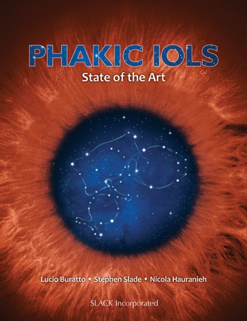 Book cover of: Phakic IOLs. By: Lucio Buratto