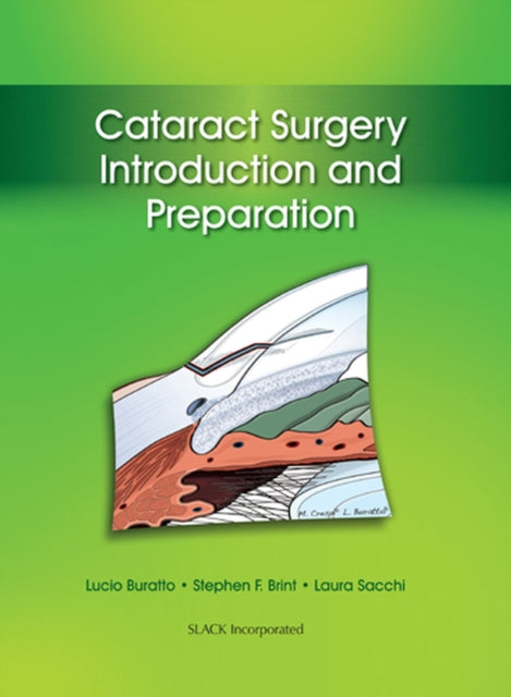 Book cover of: Cataract Surgery. By: Lucio Buratto