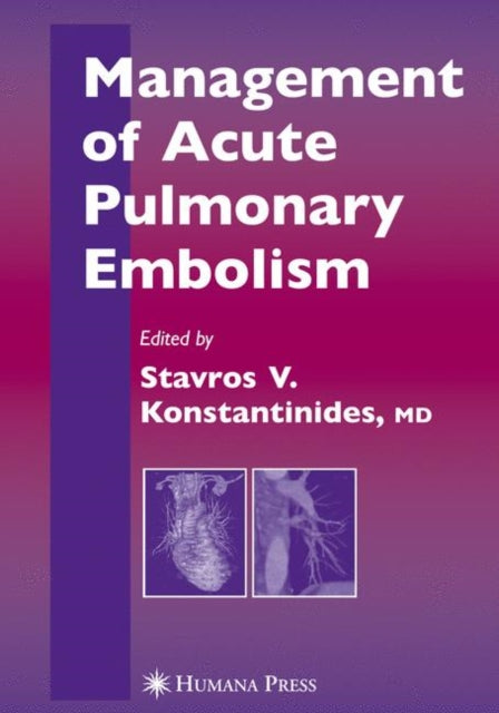 Book cover of: Management of Acute Pulmonary Embolism. By: S. Z. Goldhaber