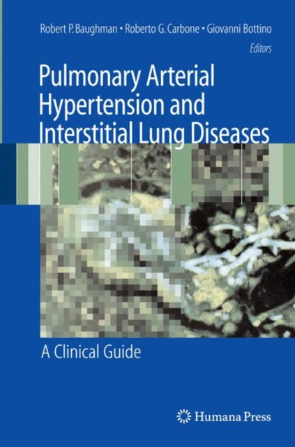 Book cover of: Pulmonary Arterial Hypertension and Interstitial Lung Diseases. By: Robert P. Baughman