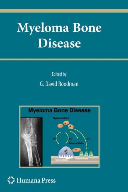 Book cover of: Myeloma Bone Disease