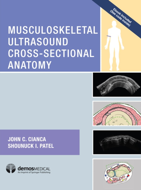 Book cover of: Musculoskeletal Ultrasound Cross-Sectional Anatomy. By: John Cianca