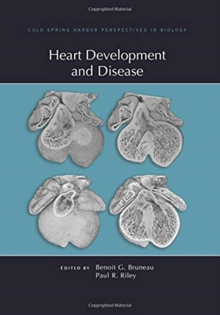 Book cover of: Heart Development and Disease. By: Benoit Bruneau