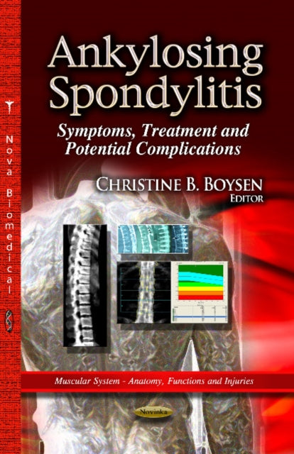 Book cover of: Ankylosing Spondylitis
