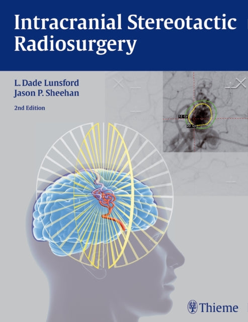 Book cover of: Intracranial Stereotactic Radiosurgery. By: L. Dade Lunsford