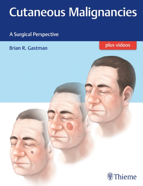 Book cover of: Cutaneous Malignancies. By: Brian Gastman