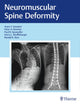 Book cover of: Neuromuscular Spine Deformity. By: Amer Samdani