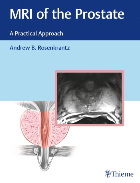 Book cover of: MRI of the Prostate. By: Andrew B. Rosenkrantz