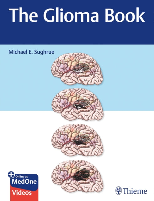 Book cover of: Glioma Book. By: Michael E. Sughrue