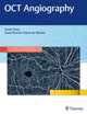 Book cover of: OCT Angiography. By: David Chow