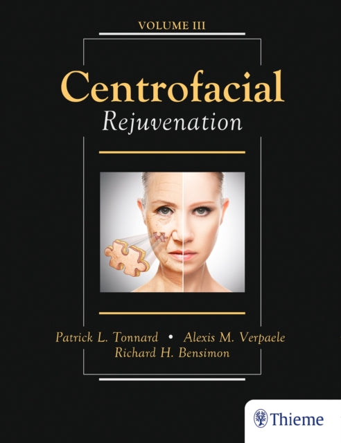 Book cover of: Centrofacial Rejuvenation. By: Patrick Tonnard