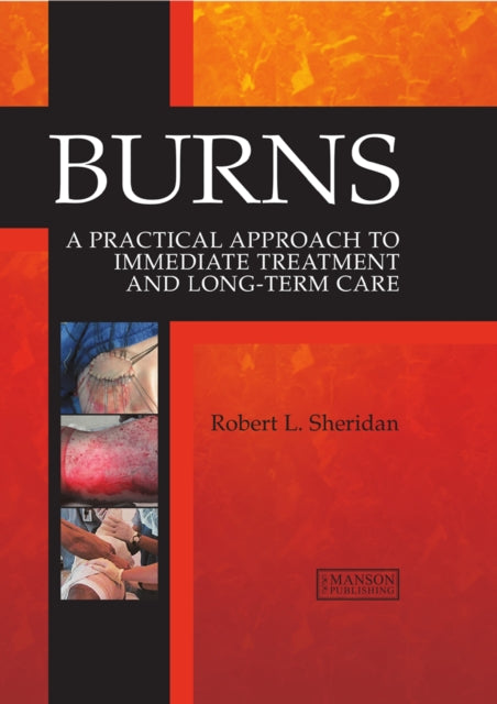 Book cover of: Burns. By: Robert Sheridan