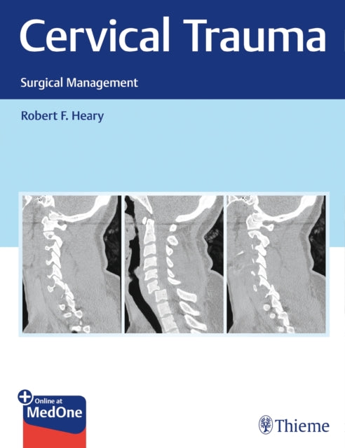 Book cover of: Cervical Trauma. By: Robert F. Heary