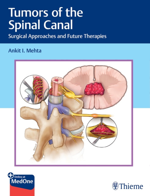 Book cover of: Tumors of the Spinal Canal. By: Ankit I. Mehta