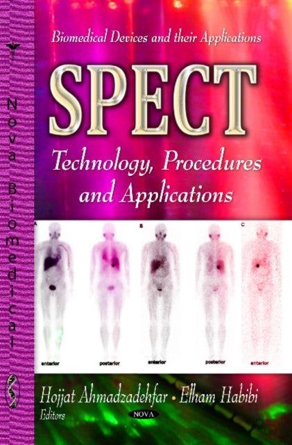 Book cover of: SPECT. By: Hojjat Ahmadzadehfar