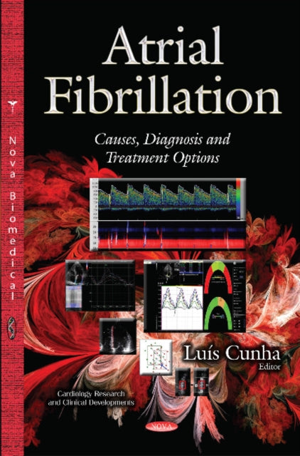 Book cover of: Atrial Fibrillation. By: Luís Cunha