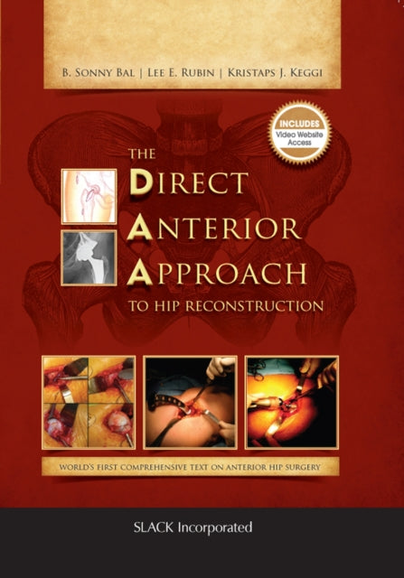 Book cover of: Direct Anterior Approach to Hip Reconstruction. By: B. Sonny Bal