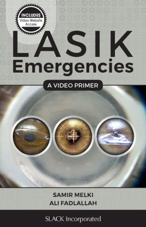 LASIK Emergencies: A Video Primer