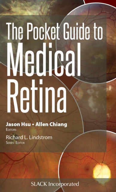 Book cover of: Pocket Guide to Medical Retina. By: Jason Hsu