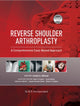 Book cover of: Reverse Shoulder Arthroplasty. By: J. Abboud
