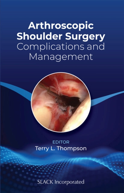 Book cover of: Arthroscopic Shoulder Surgery. By: Terry L. Thompson
