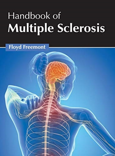 Book cover of: Handbook of Multiple Sclerosis